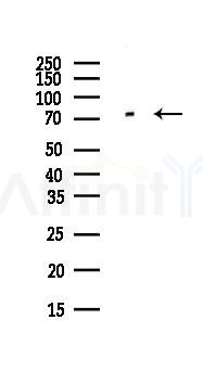 Arginyl tRNA synthetase Antibody - Western blot analysis of lysates from Hela cells(UV,30min treatment), using Arginyl tRNA synthetase Antibody at 1/1000 dilution.