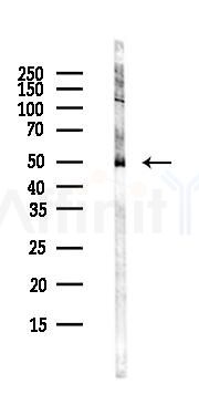 Alanine Transaminase Antibody - Western blot analysis of lysates from Hela cells(UV,30min treatment), using Alanine Transaminase Antibody at 1/1000 dilution.
