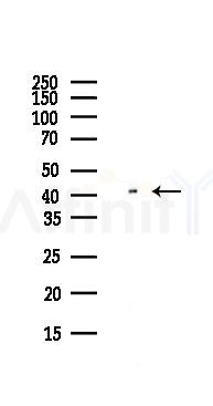 CD161 Antibody - Western blot analysis of lysates from Hela cells(UV,30min treatment), using CD161 Antibody at 1/1000 dilution.