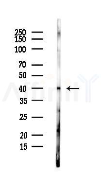 Centaurin alpha 1 Antibody - Western blot analysis of lysates from Rat brain, using Centaurin alpha 1 Antibody at 1/1000 dilution.