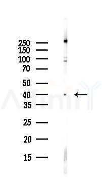 Centaurin alpha 1 Antibody - Western blot analysis of lysates from Hela cells(UV,30min treatment), using Centaurin alpha 1 Antibody at 1/1000 dilution.