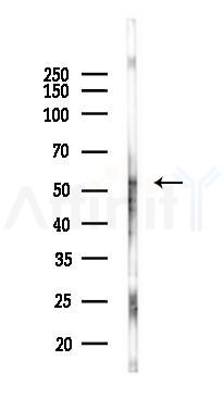 CD5 Antibody - Western blot analysis of lysates from Mouse liver, using CD5 Antibody at 1/1000 dilution.