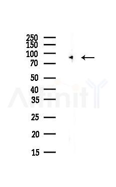 PC1 Antibody - Western blot analysis of lysates from Hela cells(UV,30min treatment), using PC1 Antibody at 1/1000 dilution.