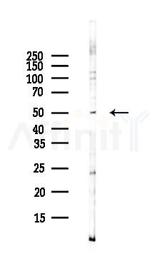 ANTXR2 Antibody - Western blot analysis of lysates from Hela cells(UV,30min treatment), using ANTXR2 Antibody at 1/1000 dilution.