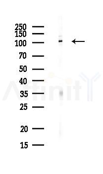 IREB2 Antibody - Western blot analysis of lysates from PC12 cells(heat-shock,45min treatment), using IREB2 Antibody at 1/1000 dilution.