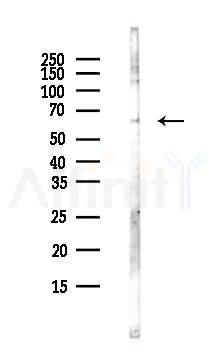 PGS1 Antibody - Western blot analysis of lysates from Hela cells(UV,30min treatment), using PGS1 Antibody at 1/1000 dilution.