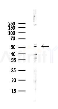 ZNF232 Antibody - Western blot analysis of lysates from Hela cells(UV,30min treatment), using ZNF232 Antibody at 1/1000 dilution.