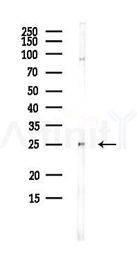 RAB3B Antibody - Western blot analysis of lysates from PC12 cells(heat-shock,45min treatment), using RAB3B Antibody at 1/1000 dilution.