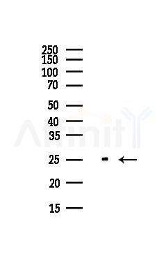 RAB3B Antibody - Western blot analysis of lysates from Hela cells(UV,30min treatment), using RAB3B Antibody at 1/1000 dilution.