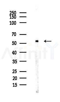 CP2BA Antibody - Western blot analysis of lysates from Mouse lung, using CP2BA Antibody at 1/1000 dilution.