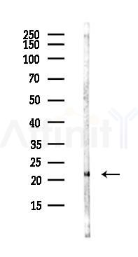 TIFA Antibody - Western blot analysis of lysates from Mouse lung, using TIFA Antibody at 1/1000 dilution.