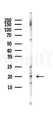CKLF6 Antibody - Western blot analysis of lysates from Hela cells(UV,30min treatment), using CKLF6 Antibody at 1/1000 dilution.