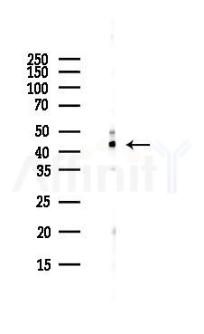 ALKBH1 Antibody - Western blot analysis of lysates from Hela cells(UV,30min treatment), using ALKBH1 Antibody at 1/1000 dilution.