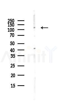 LRIG1 Antibody - Western blot analysis of lysates from Hela cells(UV,30min treatment), using LRIG1 Antibody at 1/1000 dilution.
