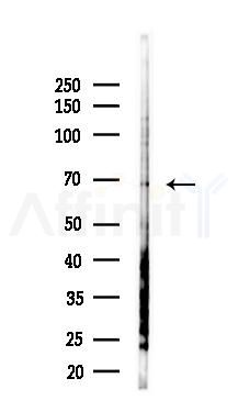 ZMYND11 Antibody - Western blot analysis of lysates from COLO205 cells(heat-shock,45min treatment), using ZMYND11 Antibody at 1/1000 dilution.