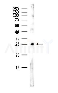 SYNGR1 Antibody - Western blot analysis of lysates from Hela cells(heat-shock,45min treatment), using SYNGR1 Antibody at 1/1000 dilution.