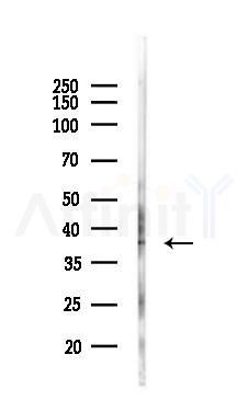 BDH1 Antibody - Western blot analysis of lysates from Rat brain, using BDH1 Antibody at 1/1000 dilution.