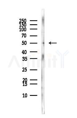 DDX49 Antibody - Western blot analysis of lysates from MCF7 cells(heat-shock,45min treatment), using DDX49 Antibody at 1/1000 dilution.