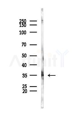 OSM Antibody - Western blot analysis of lysates from PC12 cells, using OSM Antibody at 1/1000 dilution.