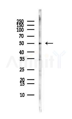 ST13 Antibody - Western blot analysis of lysates from MCF7 cells(heat-shock,45min treatment), using ST13 Antibody at 1/1000 dilution.
