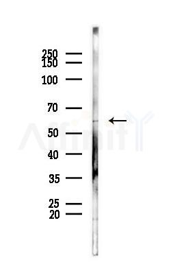 SYT6 Antibody - Western blot analysis of lysates from PC12 cells, using SYT6 Antibody at 1/1000 dilution.