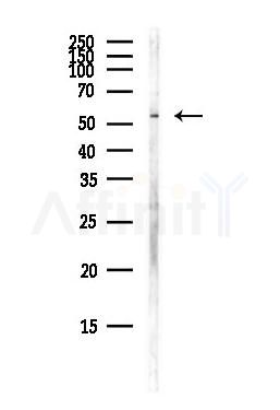 SYT6 Antibody - Western blot analysis of lysates from Hela cells(heat-shock,45min treatment), using SYT6 Antibody at 1/1000 dilution.