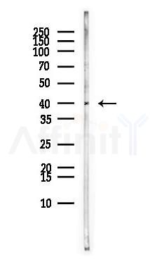 FKBP8 Antibody - Western blot analysis of lysates from MCF7 cells(heat-shock,45min treatment), using FKBP8 Antibody at 1/1000 dilution.