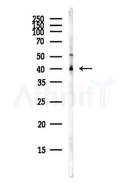 FKBP8 Antibody - Western blot analysis of lysates from Hela cells(heat-shock,45min treatment), using FKBP8 Antibody at 1/1000 dilution.