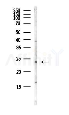 HOXB6 Antibody - Western blot analysis of lysates from Hela cells(heat-shock,45min treatment), using HOXB6 Antibody at 1/1000 dilution.