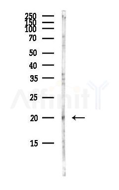 RGS13 Antibody - Western blot analysis of lysates from Hela cells(heat-shock,45min treatment), using RGS13 Antibody at 1/1000 dilution.