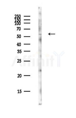 TBX4 Antibody - Western blot analysis of lysates from EC304 cells(LPS,4h treatment), using TBX4 Antibody at 1/1000 dilution.
