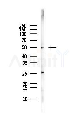 ETF1 Antibody - Western blot analysis of lysates from MCF7 cells(heat-shock,45min treatment), using ETF1 Antibody at 1/1000 dilution.