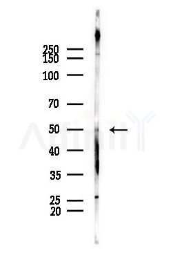 ETF1 Antibody - Western blot analysis of lysates from PC12 cells, using ETF1 Antibody at 1/1000 dilution.