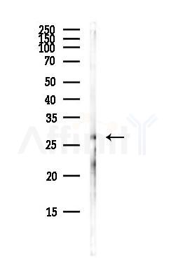 CACNG6 Antibody - Western blot analysis of lysates from Hela cells(heat-shock,45min treatment), using CACNG6 Antibody at 1/1000 dilution.