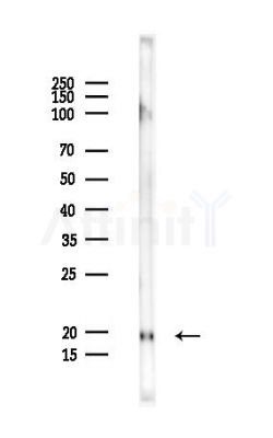 SAP18 Antibody - Western blot analysis of lysates from Rat spleen, using SAP18 Antibody at 1/1000 dilution.