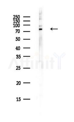 DDX1 Antibody - Western blot analysis of lysates from PC12 cells(heat-shock,45min treatment), using DDX1 Antibody at 1/1000 dilution.