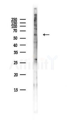 ZNF266 Antibody - Western blot analysis of lysates from Hela cells(heat-shock,45min treatment), using ZNF266 Antibody at 1/1000 dilution.