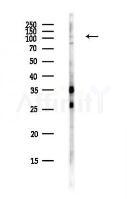 SMG5 Antibody - Western blot analysis of lysates from PC12 cells(heat-shock,45min treatment), using SMG5 Antibody at 1/1000 dilution.
