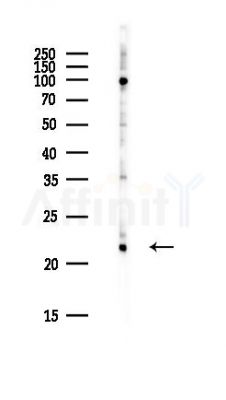 CFAP20 Antibody - Western blot analysis of lysates from PC12 cells(heat-shock,45min treatment), using CFAP20 Antibody at 1/1000 dilution.