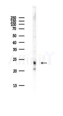 CFAP20 Antibody - Western blot analysis of lysates from Hela cells(heat-shock,45min treatment), using CFAP20 Antibody at 1/1000 dilution.
