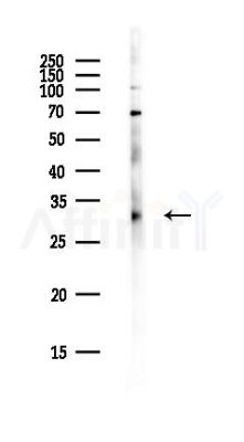 C1QTNF4 Antibody - Western blot analysis of lysates from PC12 cells(heat-shock,45min treatment), using C1QTNF4 Antibody at 1/1000 dilution.