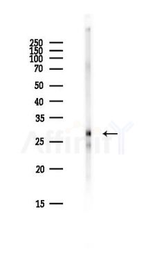 C1QTNF6 Antibody - Western blot analysis of lysates from Hela cells(heat-shock,45min treatment), using C1QTNF6 Antibody at 1/1000 dilution.