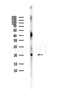 UBE2E1 Antibody - Western blot analysis of lysates from HUVEC cells(LPS,4h treatment), using UBE2E1 Antibody at 1/1000 dilution.