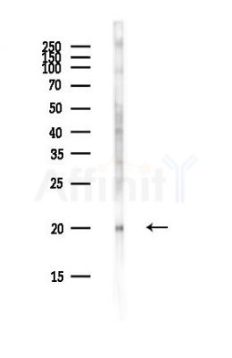 UBE2E1 Antibody - Western blot analysis of lysates from EC304 cells(LPS,4h treatment), using UBE2E1 Antibody at 1/1000 dilution.