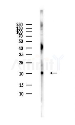 UBE2E1 Antibody - Western blot analysis of lysates from HUVEC cells(LPS,4h treatment), using UBE2E1 Antibody at 1/1000 dilution.