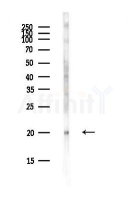 UBE2E1 Antibody - Western blot analysis of lysates from EC304 cells(LPS,4h treatment), using UBE2E1 Antibody at 1/1000 dilution.