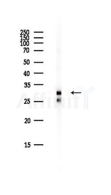 DGUOK Antibody - Western blot analysis of lysates from Hela cells(heat-shock,45min treatment), using DGUOK Antibody at 1/1000 dilution.