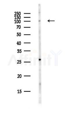 USP4 Antibody - Western blot analysis of lysates from PC12 cells(heat-shock,45min treatment), using USP4 Antibody at 1/1000 dilution.