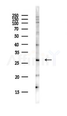 DKKL1 Antibody - Western blot analysis of lysates from PC12 cells(heat-shock,45min treatment), using DKKL1 Antibody at 1/1000 dilution.