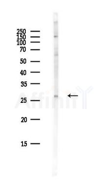 DKKL1 Antibody - Western blot analysis of lysates from Hela cells(heat-shock,45min treatment), using DKKL1 Antibody at 1/1000 dilution.